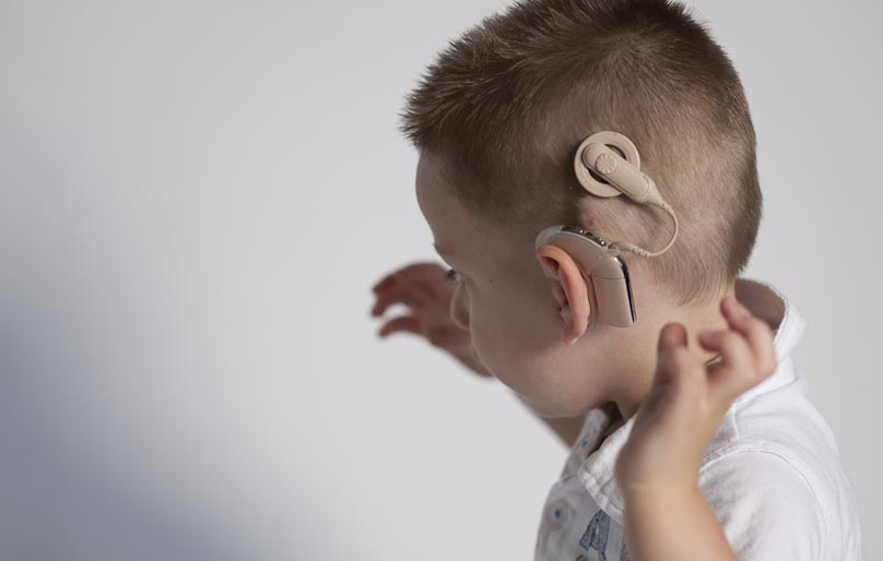 On Sunday the installation of 250th cochlear implant for residents of Manitoba was celebrated